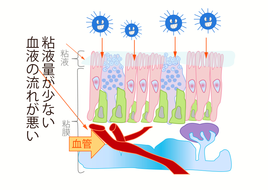 乾燥や血流悪化でウイルスは侵入しやすい